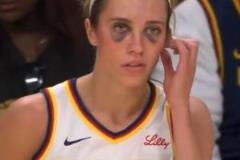 WNBA狂熱前鋒赫爾強度堪比CBA！被“打成熊貓”